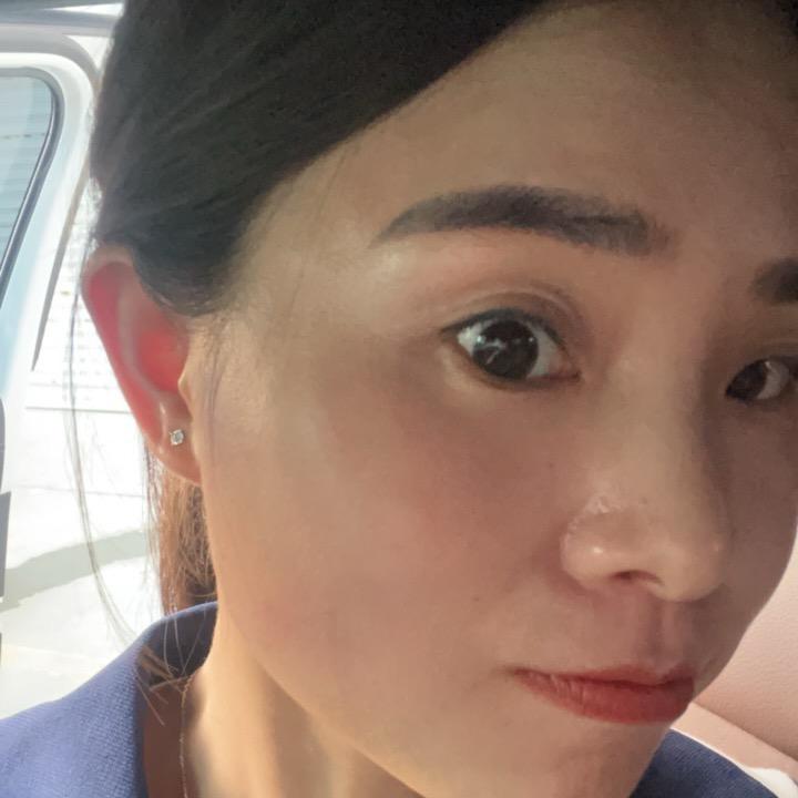 小琳