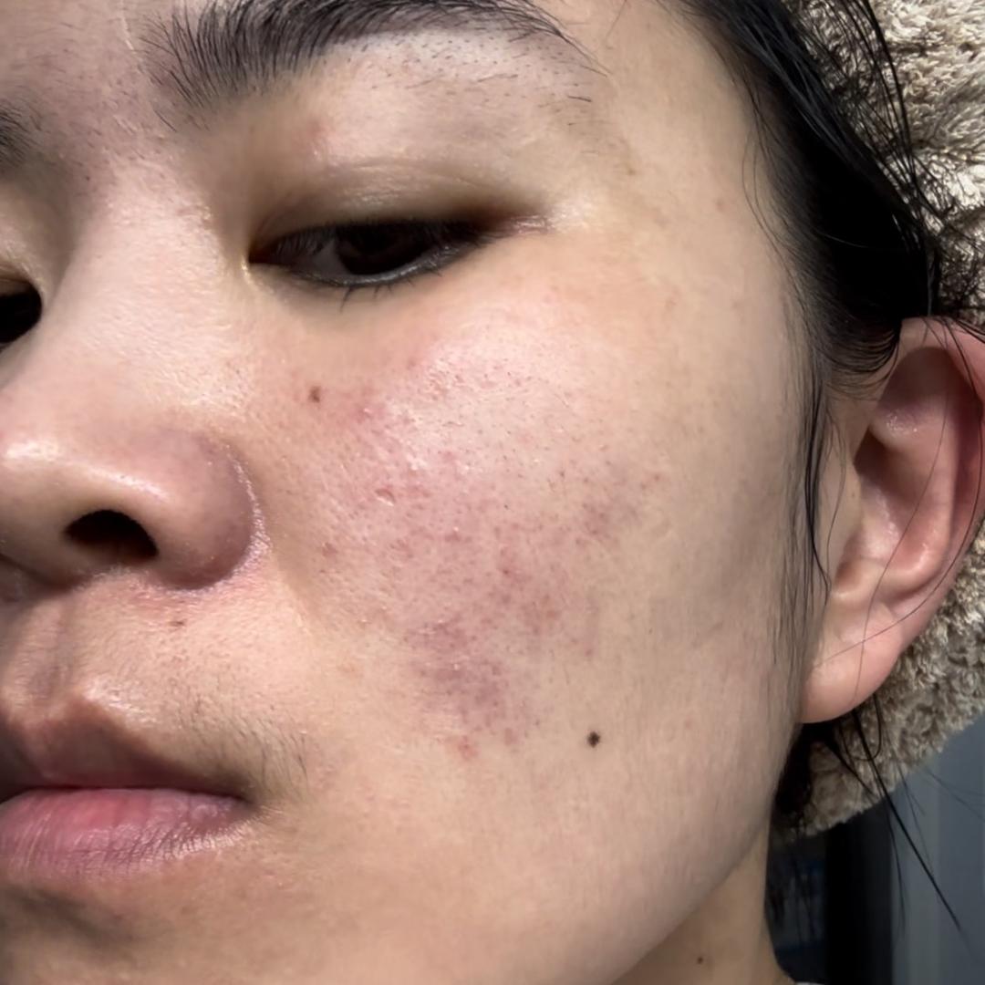 玫瑰小胡（9月6日肤乐希贻贝精华大专场）