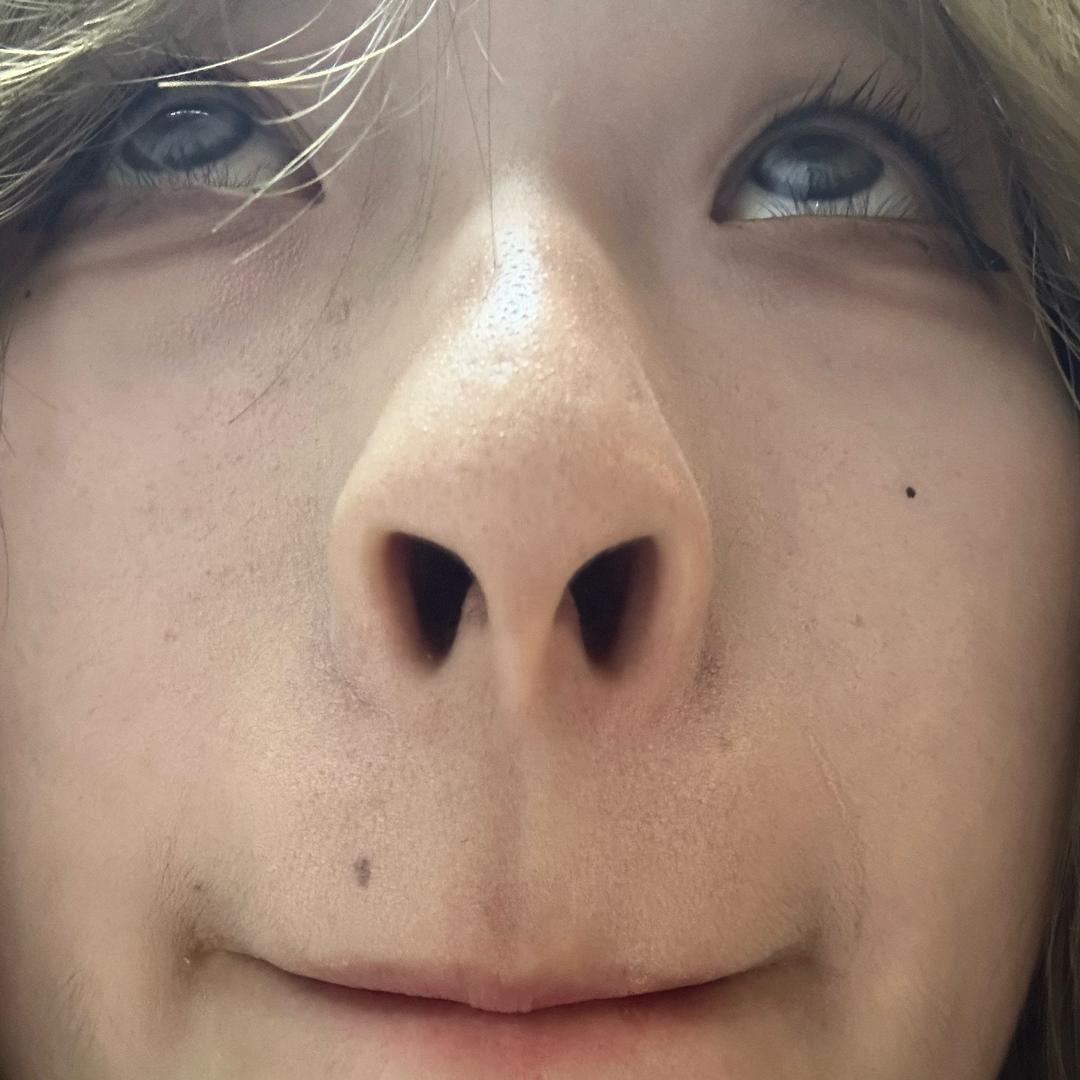 小🌲的大🌲（发疯号之日更版）