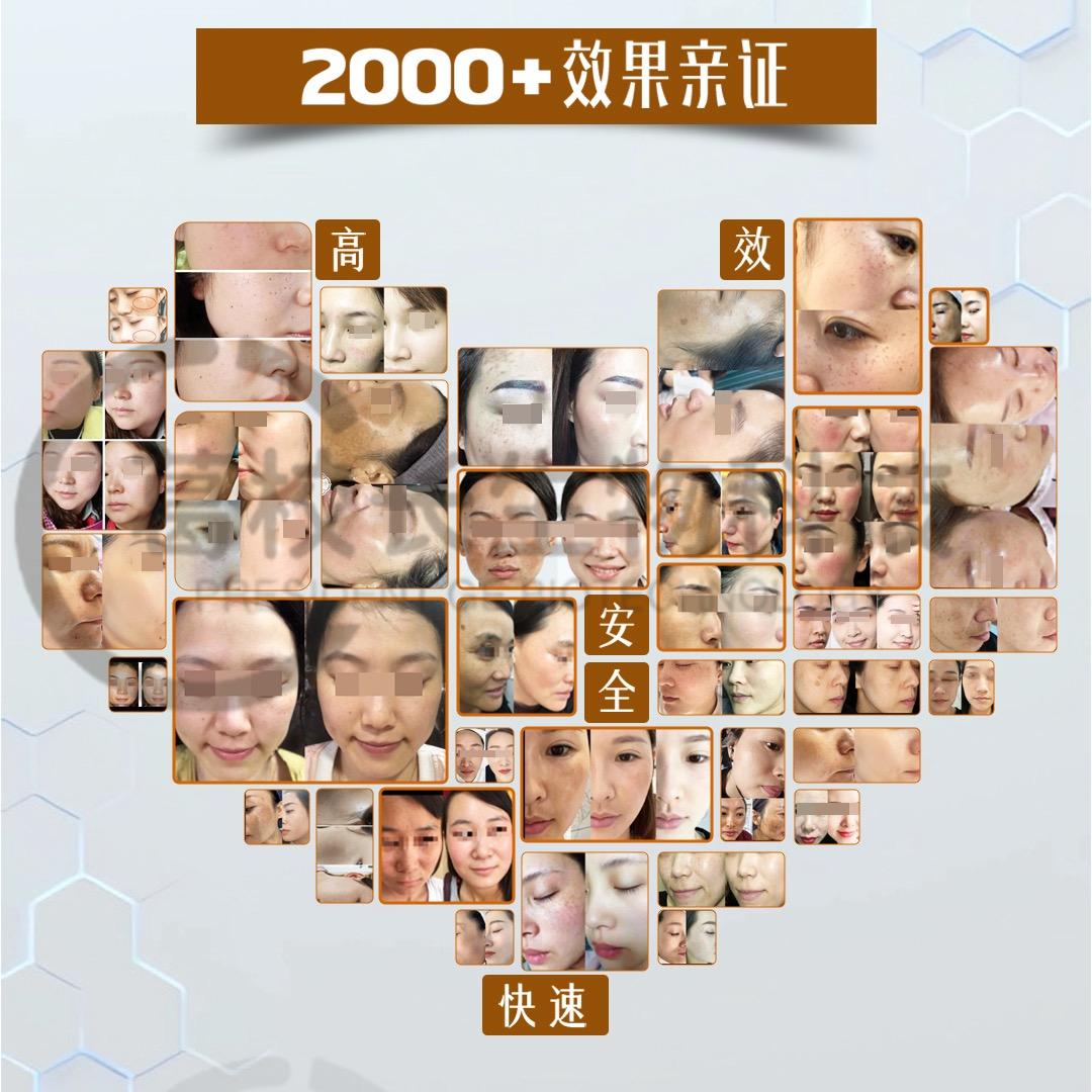 秀姿蓝黛～西南市场冯老师