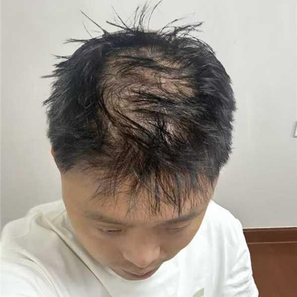 乐乐的小草出来了