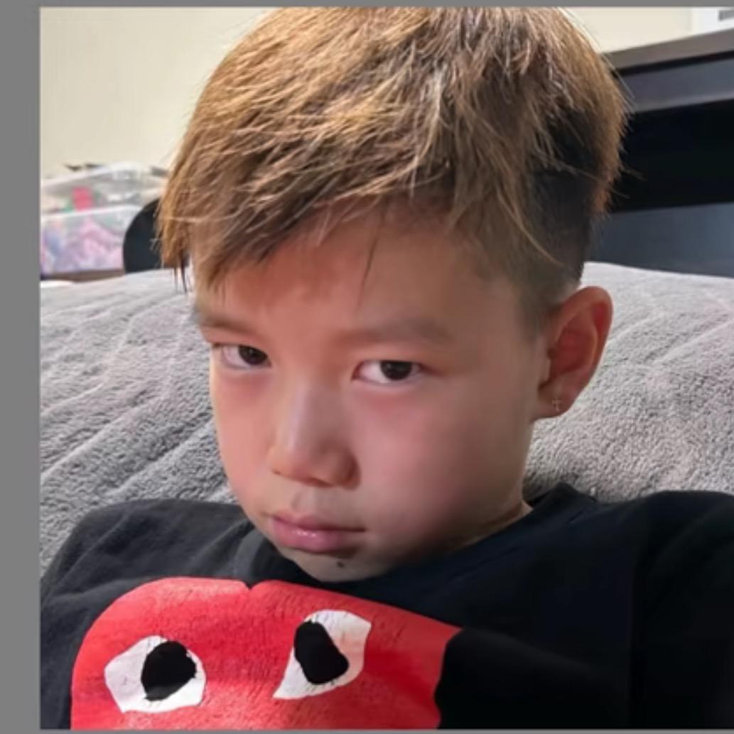 ￴ ￴ ￴￴￴￴ ￴耍帅被打掉两颗虎牙