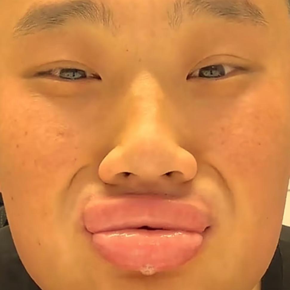 下了个蛋