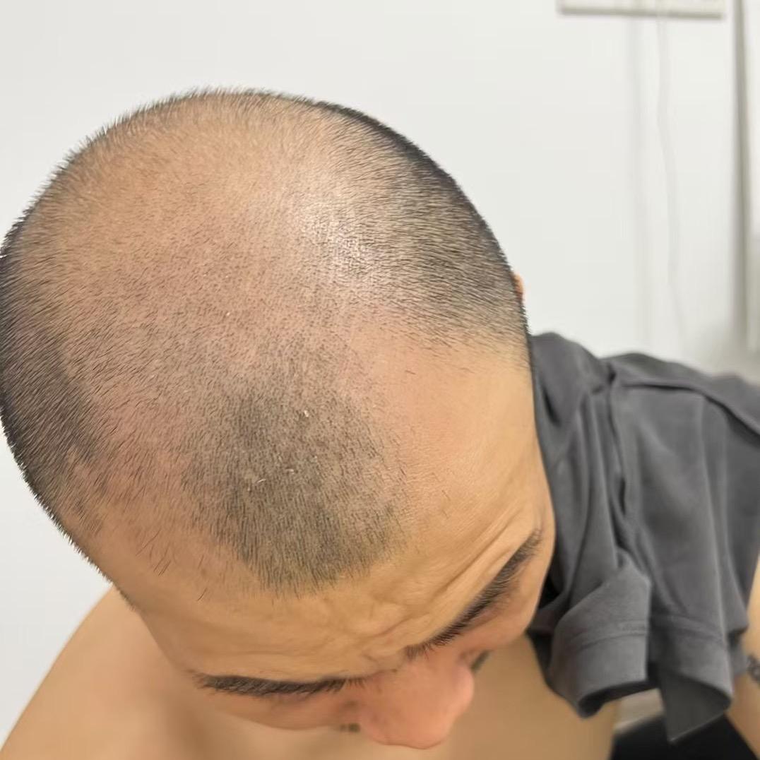 程先生不秃头