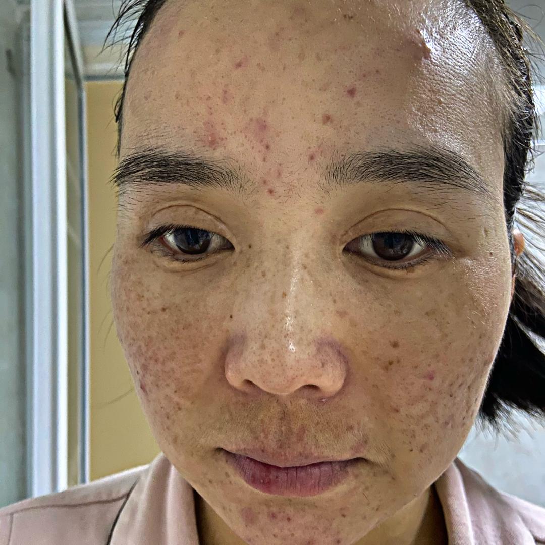 @筱冉你的护肤老师