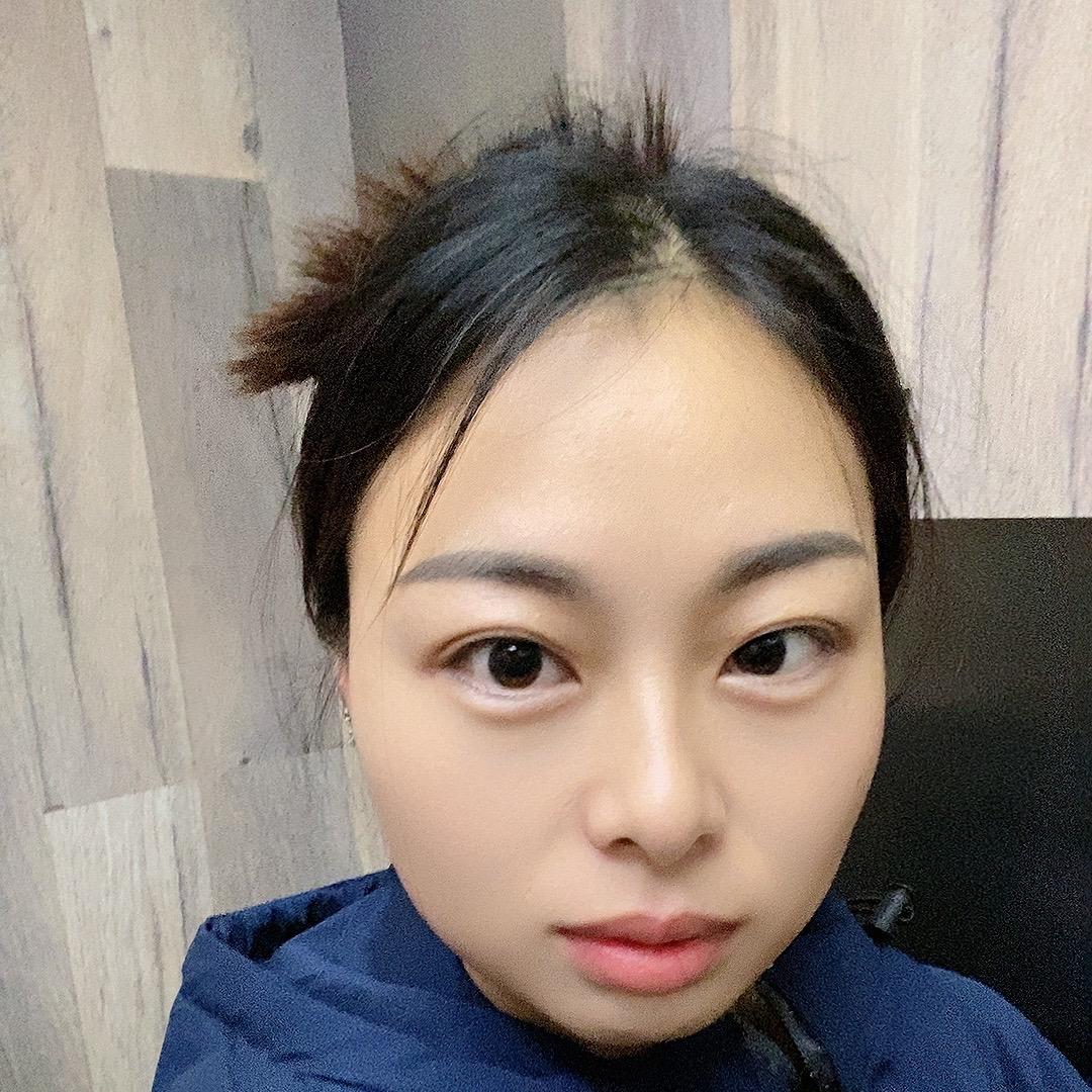 佳