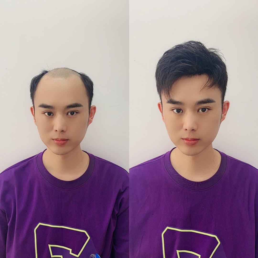 定州安森假发补发