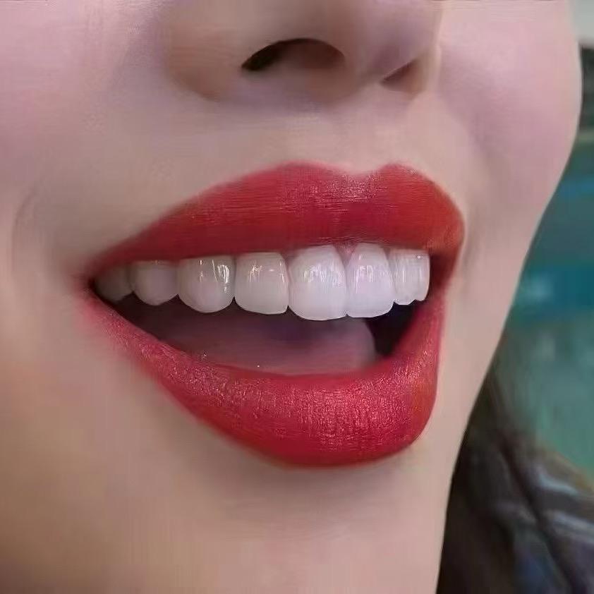 微微一笑很倾城