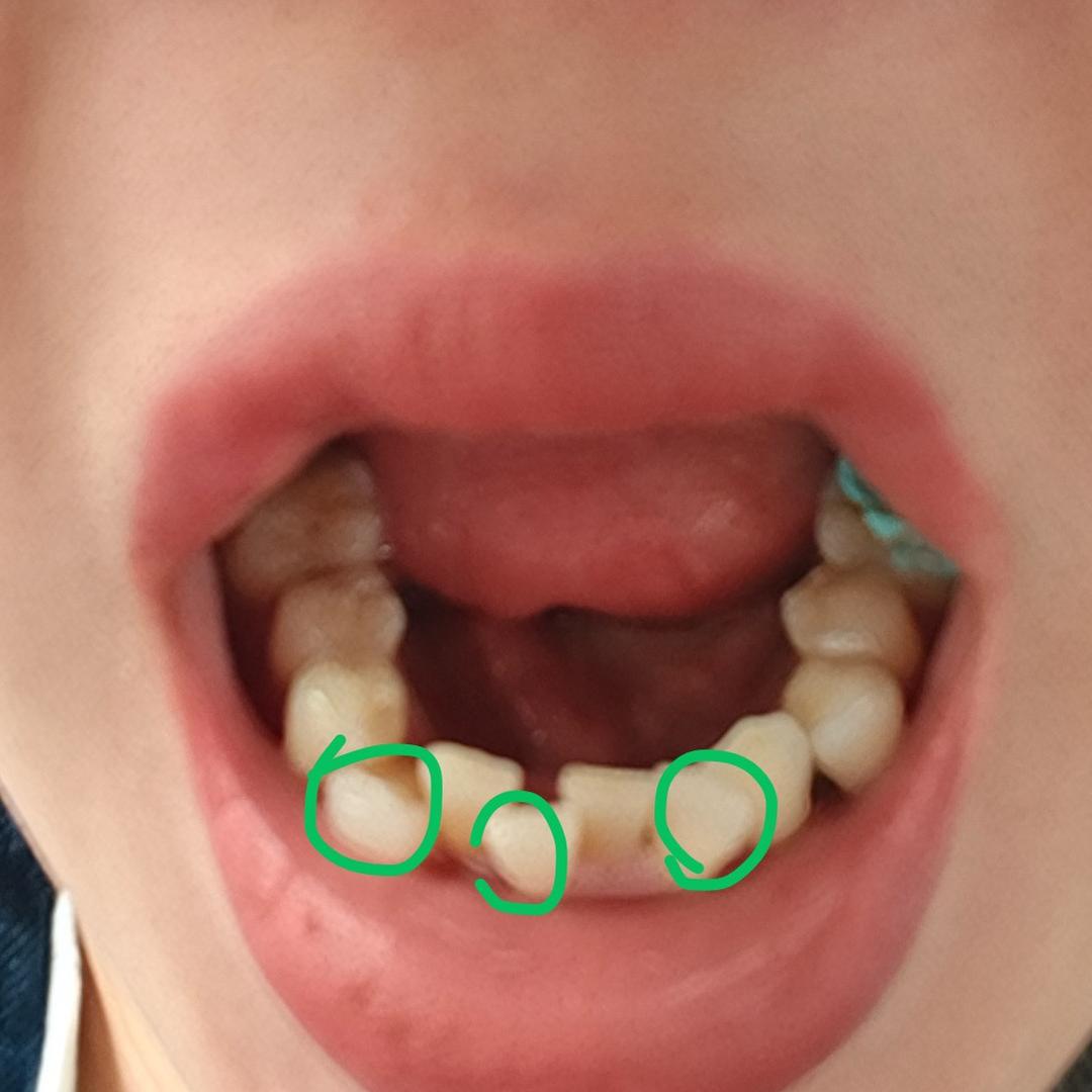 缅甸翡翠受害者