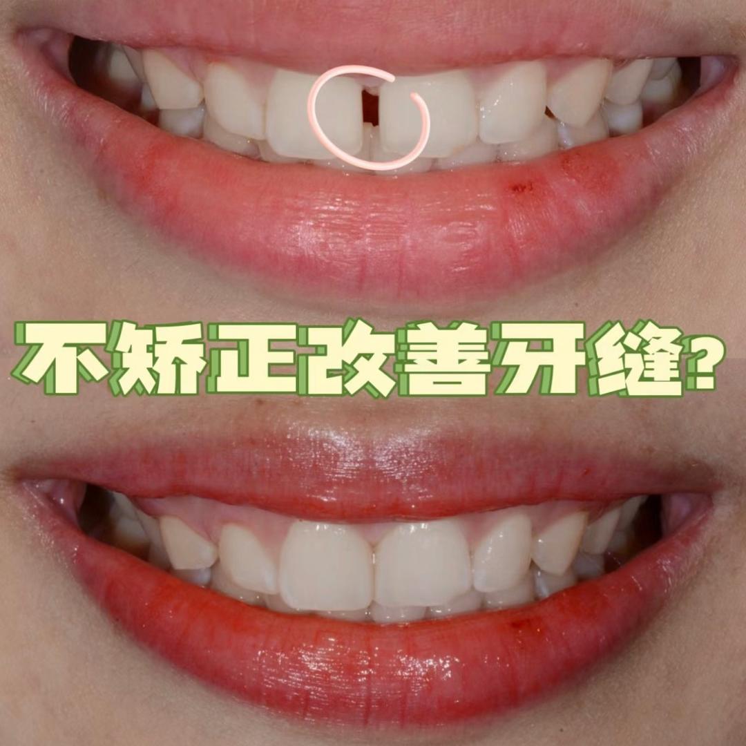 瑞城小陈