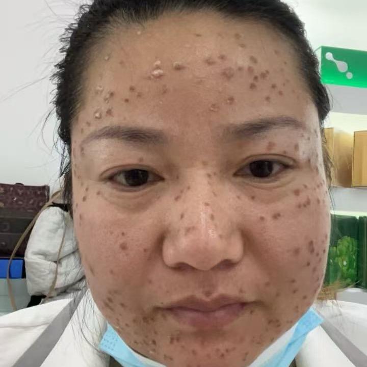 问题肌管理师琦琦