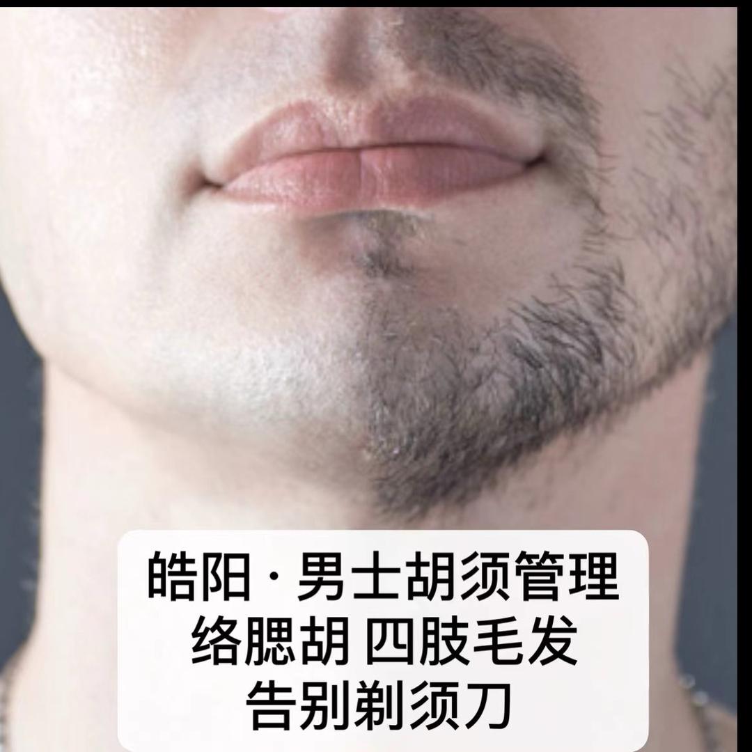 济宁皓阳胡须管理