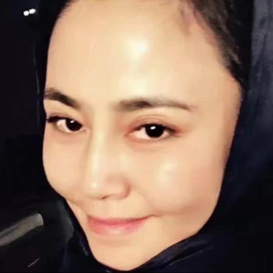 好点儿