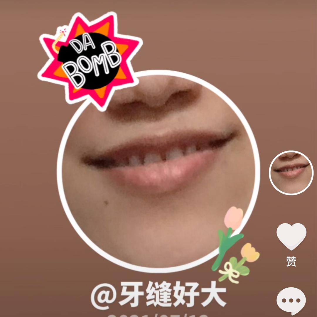 我叫面面🤪