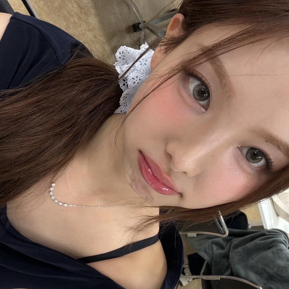 Na.