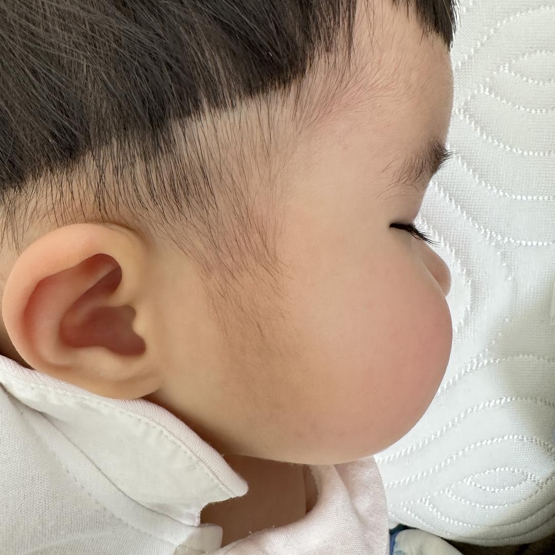 段