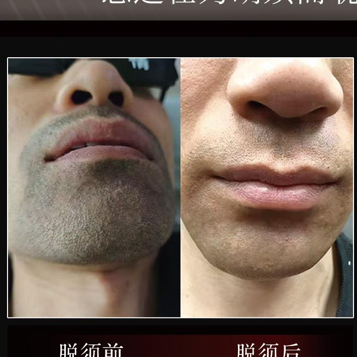 吴忠【清理胡须体毛】