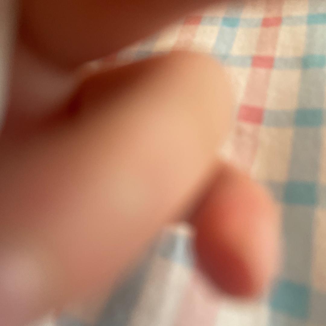 右边的金太阳🌞