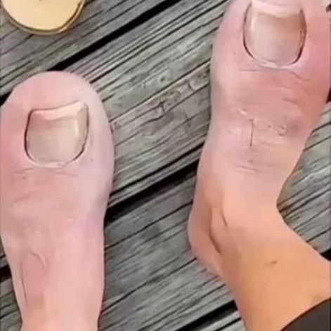 两只脚趾跑得快