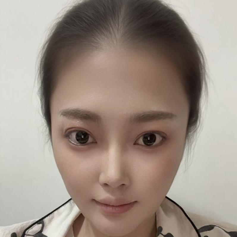 发量王