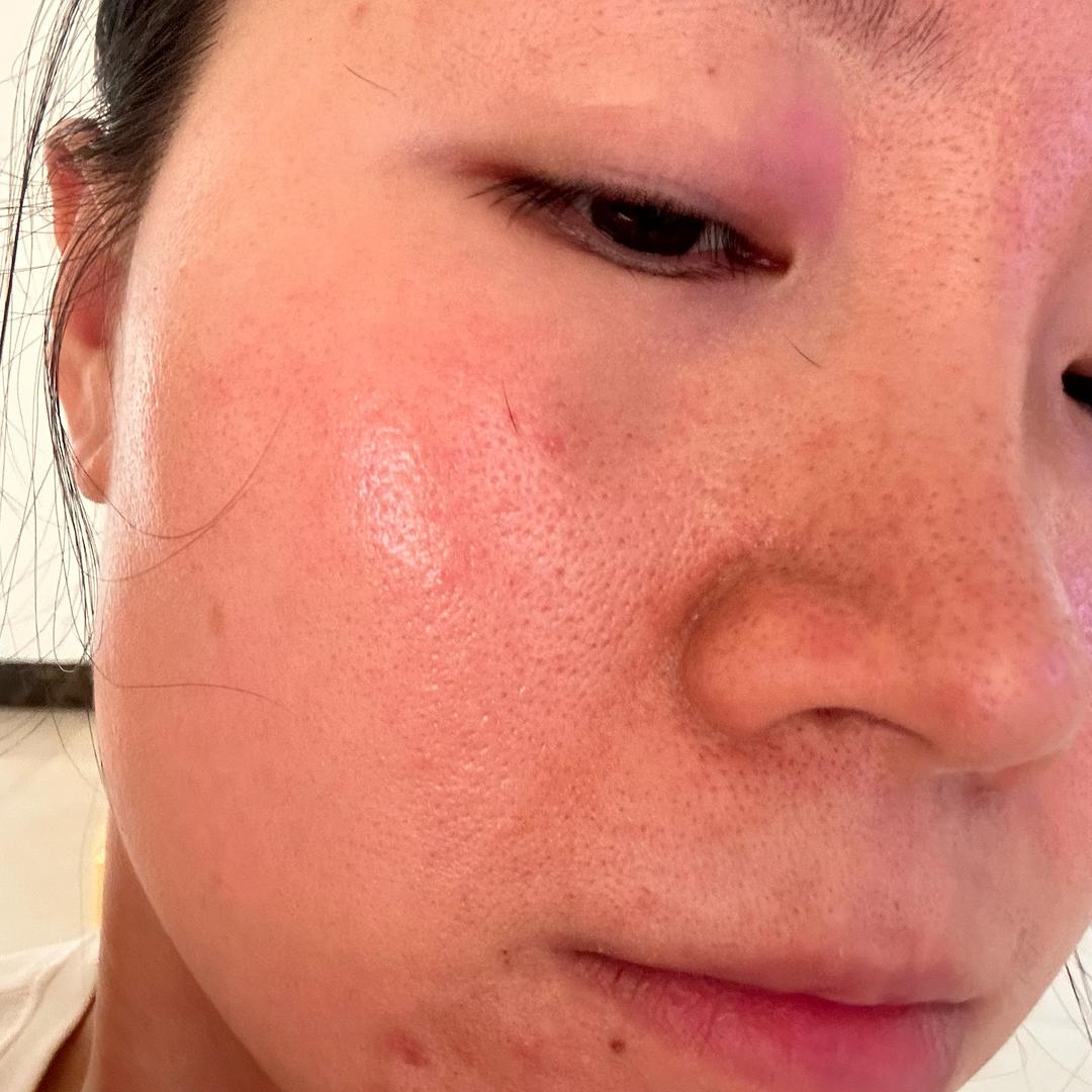 大红脸妍姑凉修复中