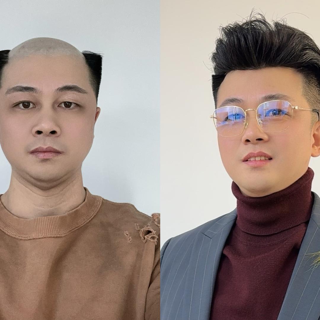 摩登假发补发