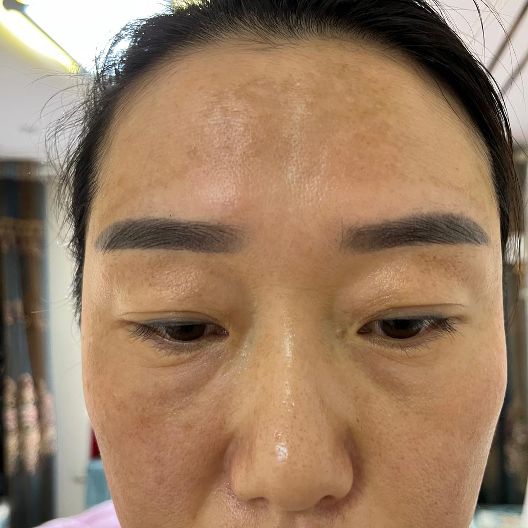 新郑专做斑小敏