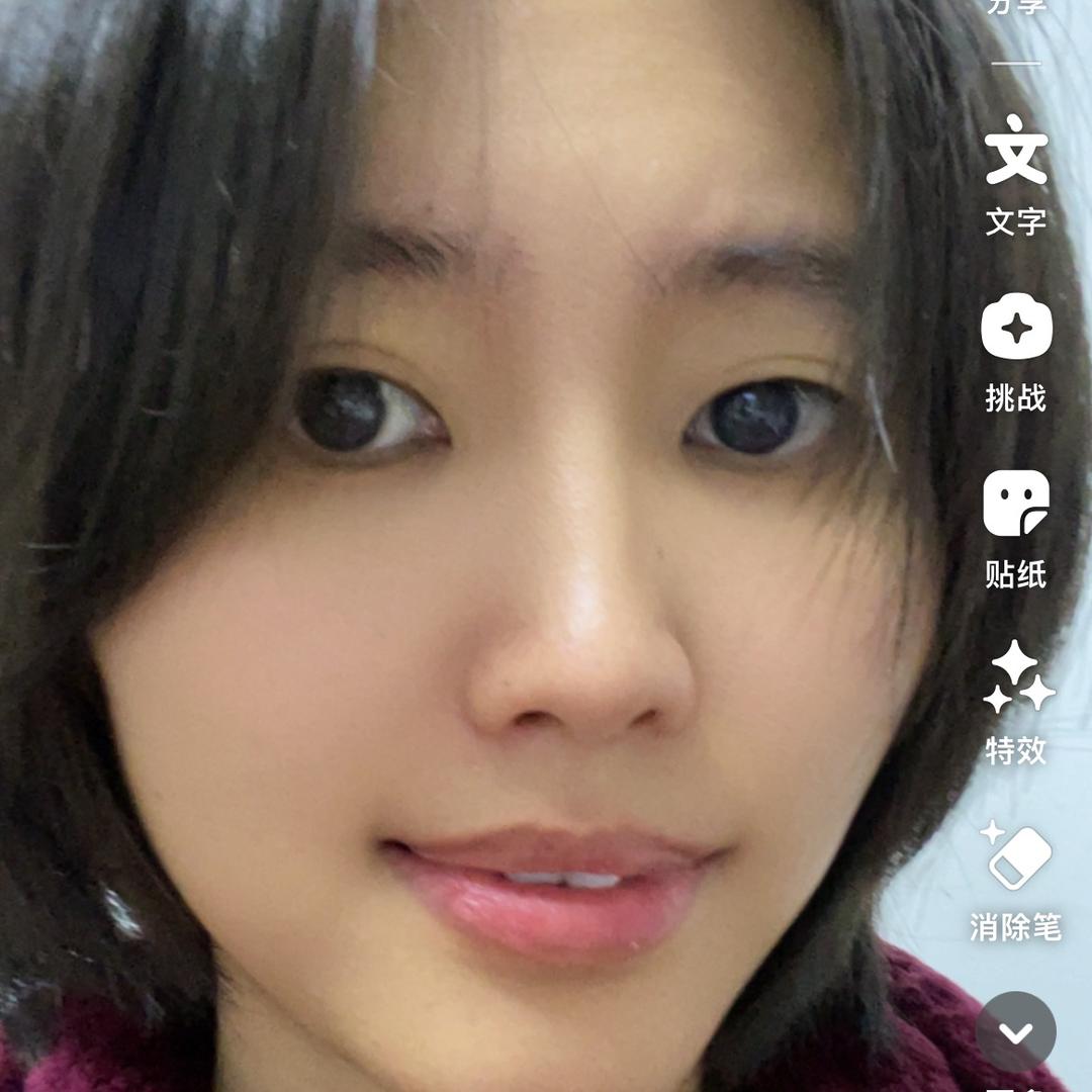 小雅