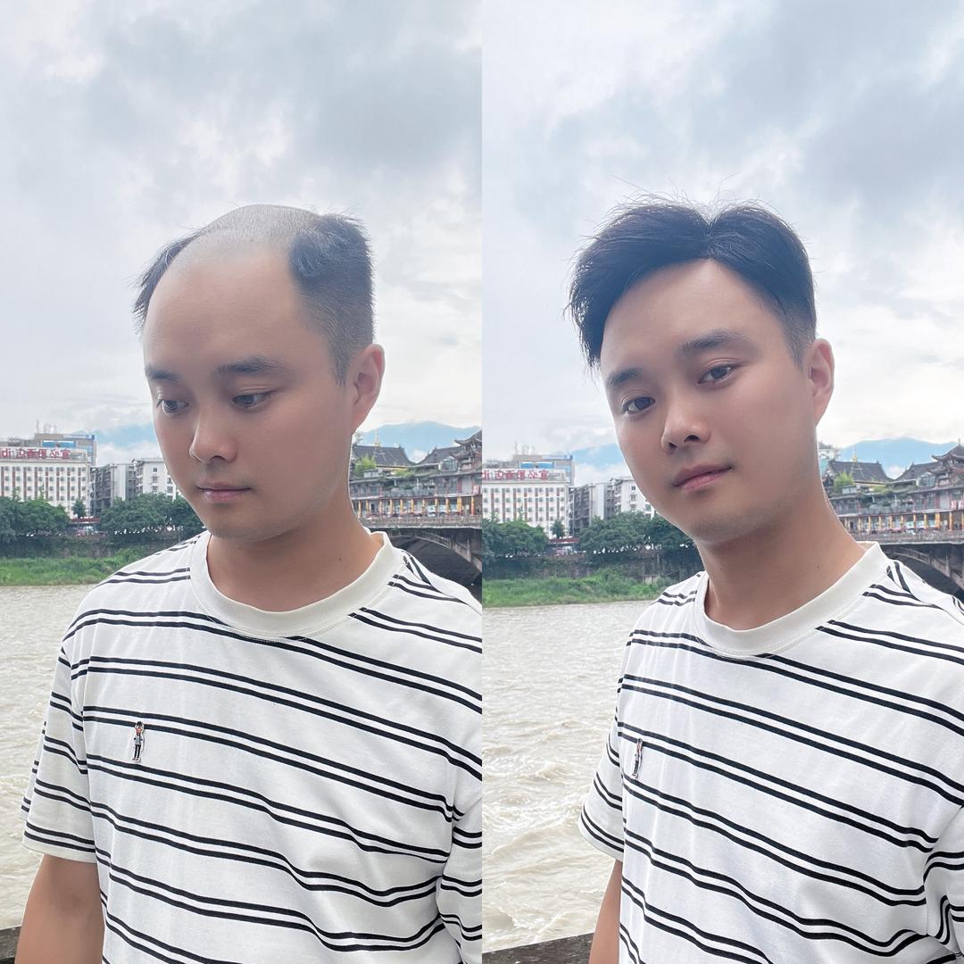 雅安纱龙微假发定制（高价回收长头发）