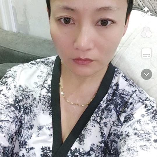 巧儿，晚期癌症患者