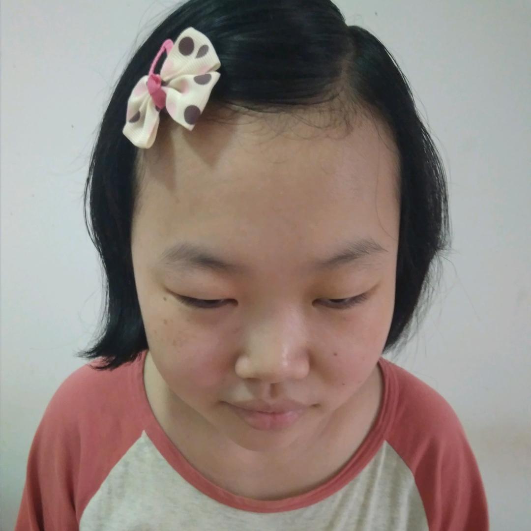 盲人悦悦