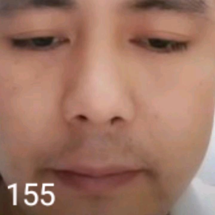 奇迹