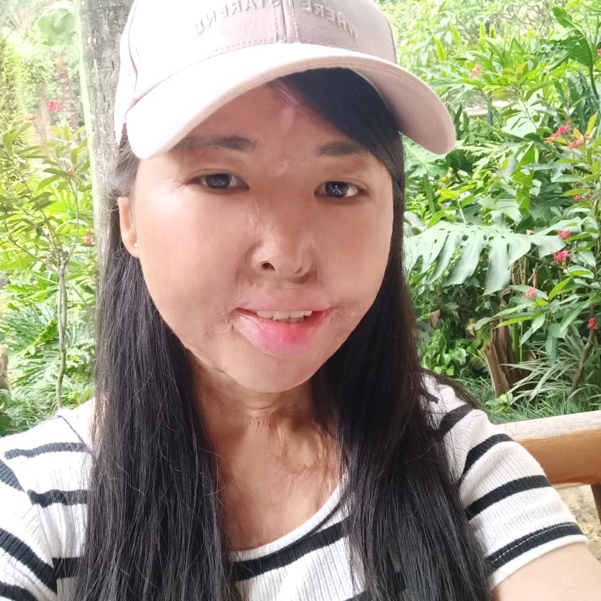 @阿梅（阳光终在风雨后）