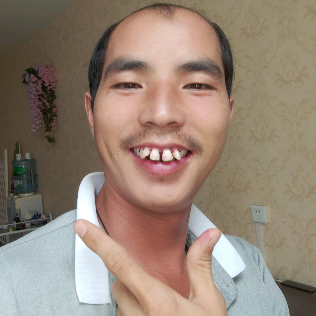 云南牙擦苏