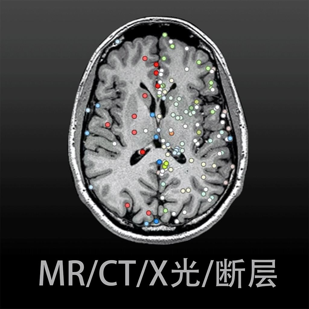 影像解剖图谱APP