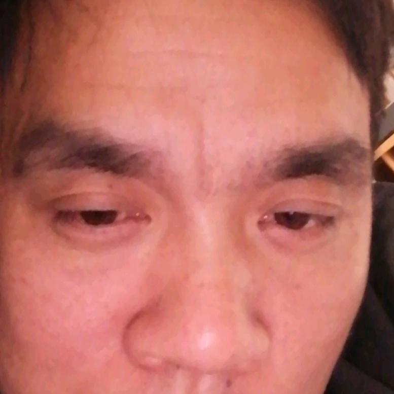 张进勇