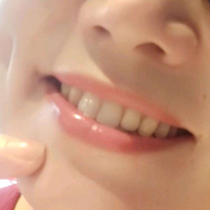 香