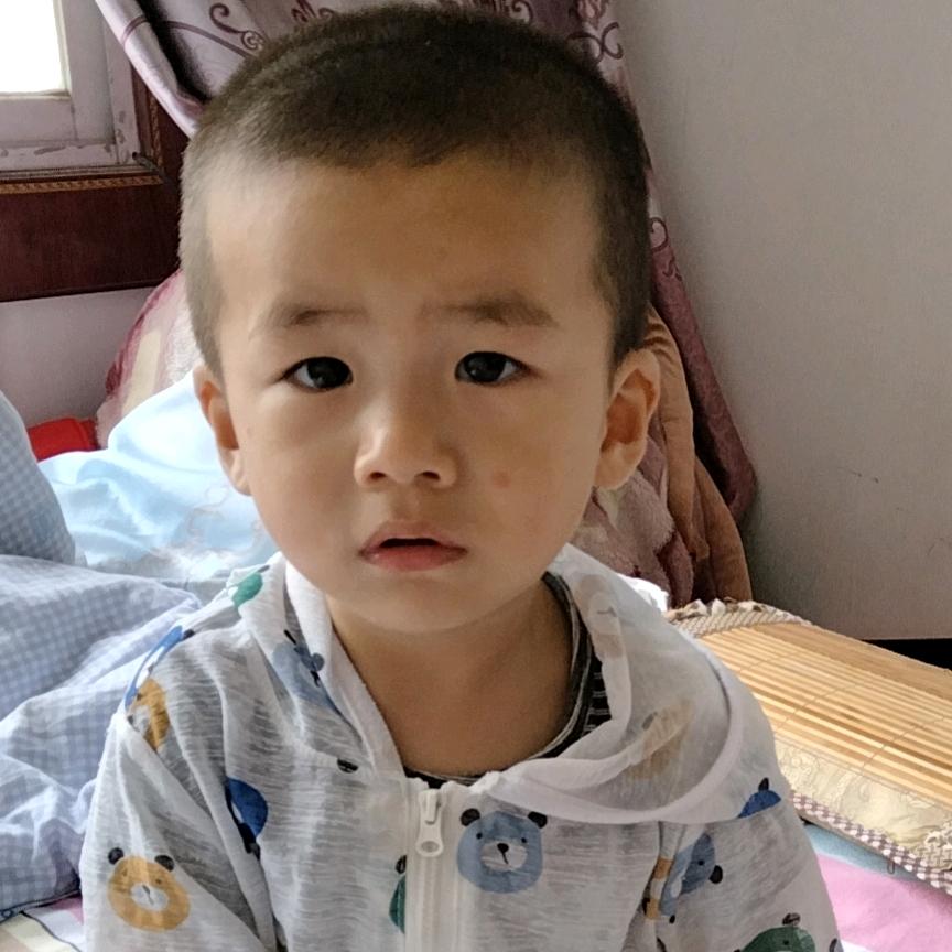 小太阳