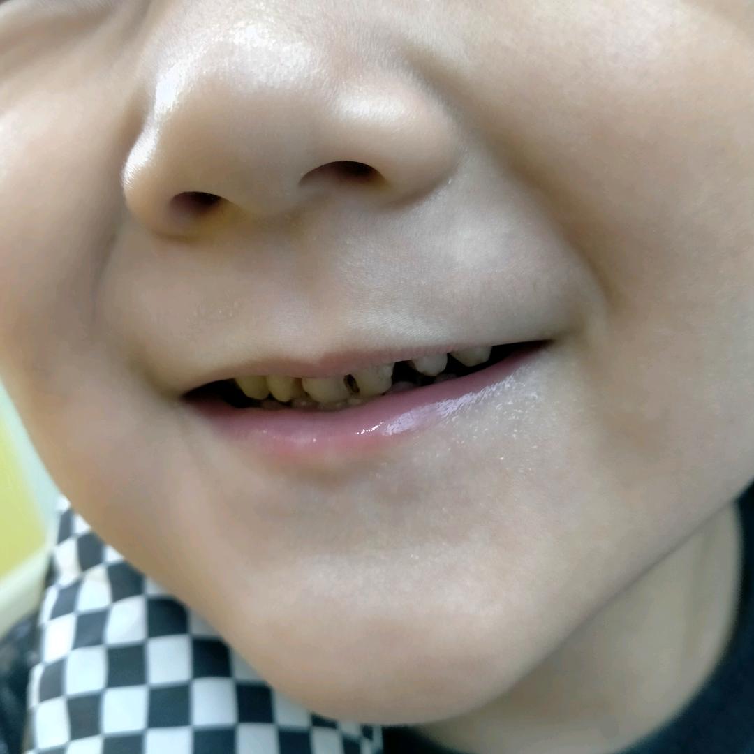 鹿邑县优学派AI学习机