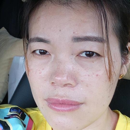 庆👄玲👄珑