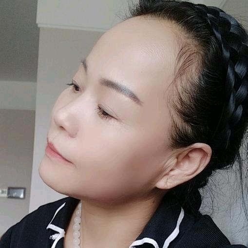 红果树