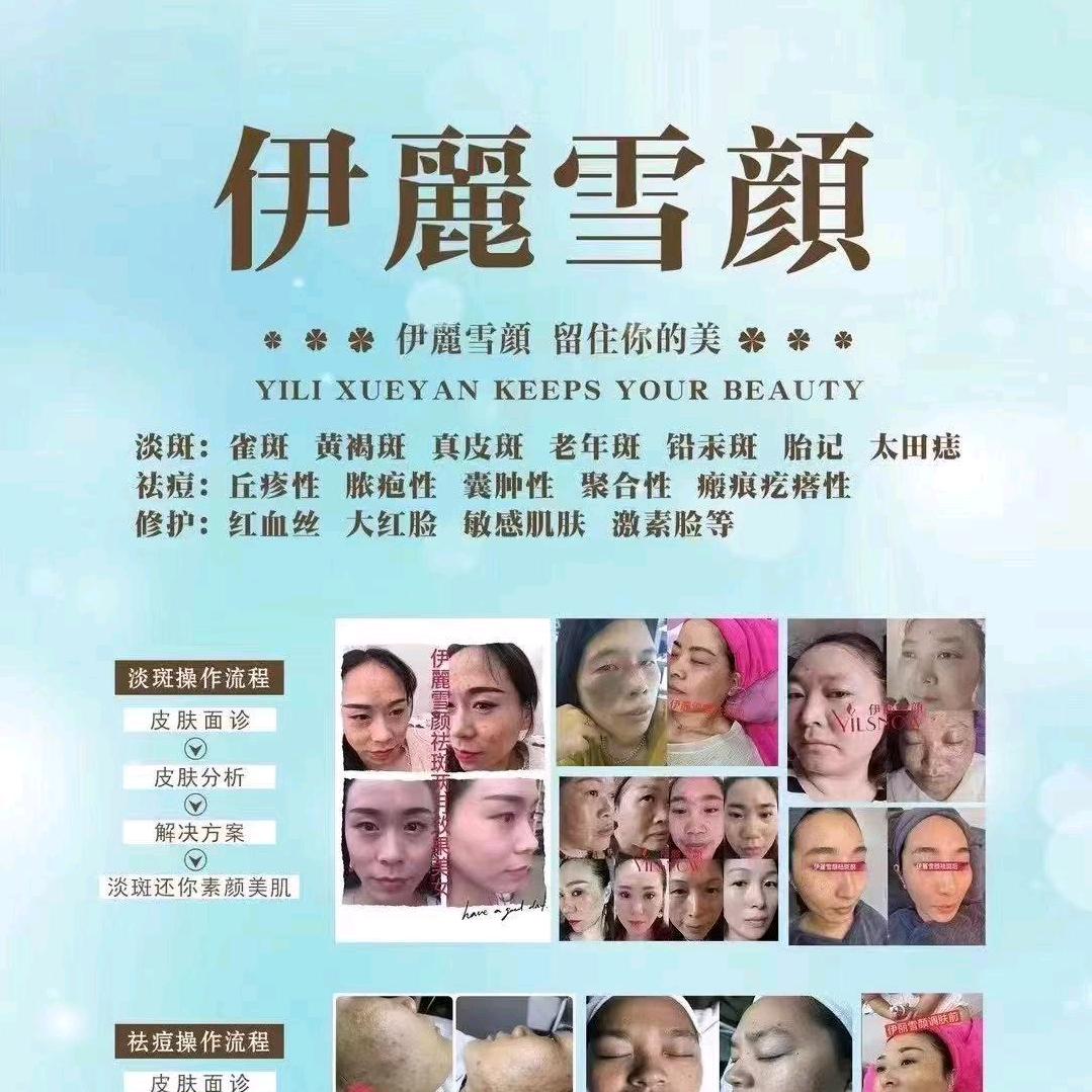 伊丽雪颜问题性肌肤招加盟