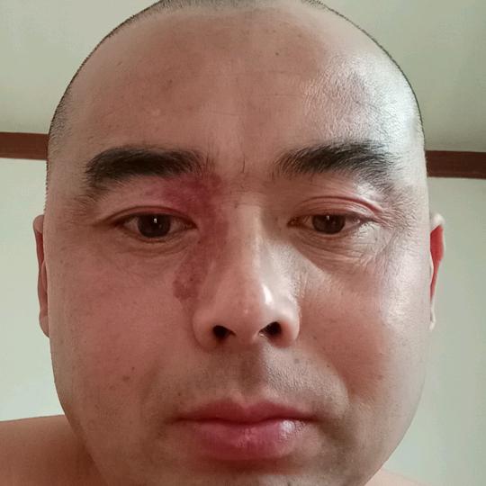 超哥