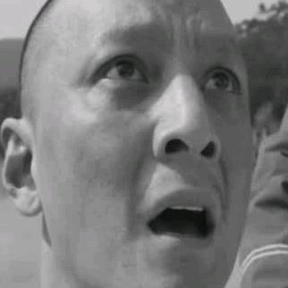老年痴呆患者