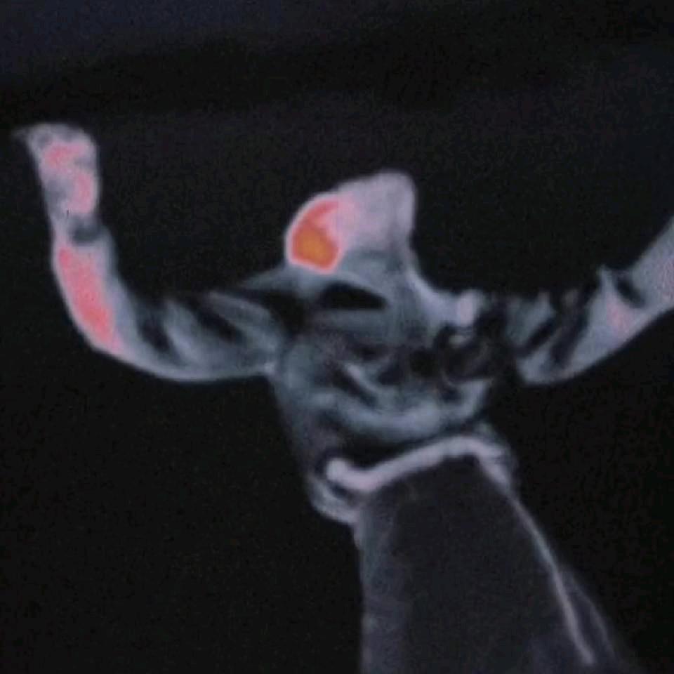 Si