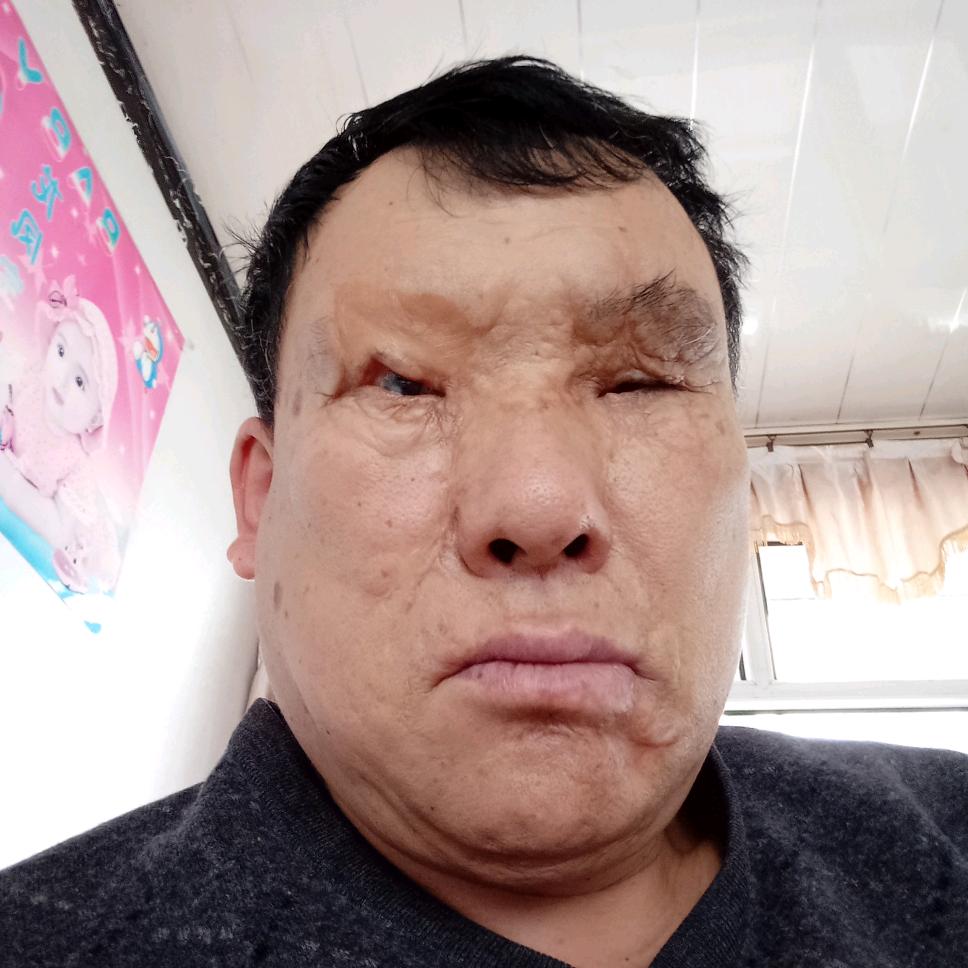农民