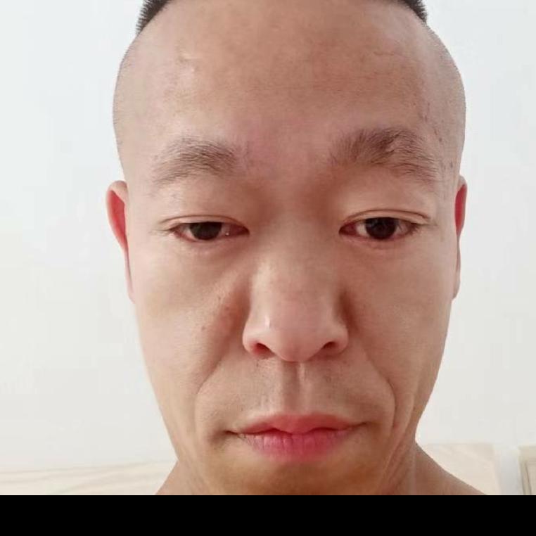 袖珍小男孩名字叫阿华