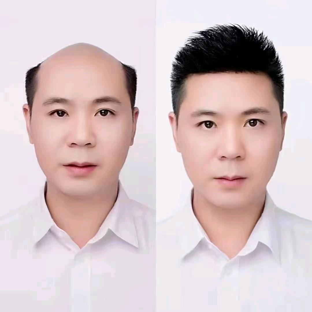 新疆艾尼雅补发