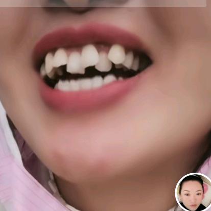 暴牙姐