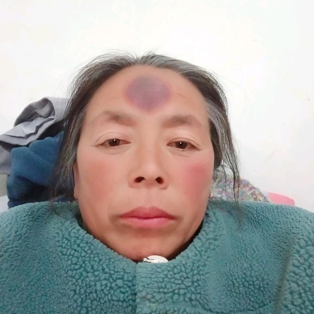 霍花眼